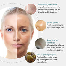 Load image into Gallery viewer, Electric Facial Cleansing Brush EMS Lifting and Introduction Massager Blackhead Removal and Pore Beauty Instrument Facial Skin Care