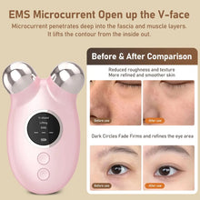 Load image into Gallery viewer, Facial Massager EMS Microcurrent Lifting Device Face Roller Anti Wrinkle V Shape Lift Chin-up Face Lift Machine Skincare Tool