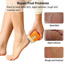 Load image into Gallery viewer, Electric Foot Grinder Mini Portable Foot Callus Remover USB Rechargeable Foot Exfoliation Predicure Grinding Dead Skin Remover