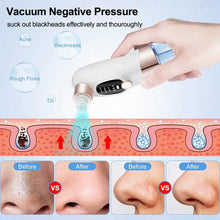 Load image into Gallery viewer, Electric Blackhead Remover Pore Vacuum Cleaner Facial Black Dots Vacuum Cleaner Pimple Acne Blackhead Removal Black Dots Remover