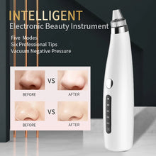 Load image into Gallery viewer, Blackhead Remover Electric Vacuum Suction Blemish Cleaner Face Care Tool Pore Nose Acne Pimple Needle Tag Removal Beauty Health