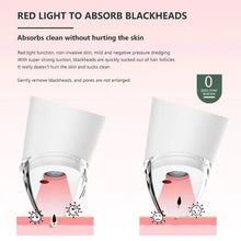 Load image into Gallery viewer, Electric Black Head Instrument Acne Removal Machine Tool Pore Cleaner Vacuum Blackhead Remover