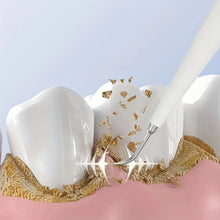 Load image into Gallery viewer, Electric Teeth Whitening Dental Calculus Scaler Plaque Coffee Stain Tartar Removal High Frequency Sonic Toothbrush Teeth Cleaner