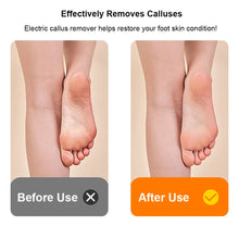 Load image into Gallery viewer, Electric Foot Grinder Mini Portable Foot Callus Remover USB Rechargeable Foot Exfoliation Predicure Grinding Dead Skin Remover