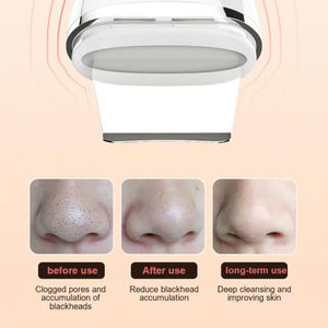 Ultrasonic Skin Scrubber Deep Face Cleaning Machine Peeling Shovel Facial Pore Cleaner Face Skin Scrubber Lift Machine