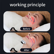 Load image into Gallery viewer, Smart Anti Snoring Device Dual Pulse Muscle Stimulator Stop Snore Relaxation Treatment Health Care Improve Sleeping Effective