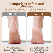 Load image into Gallery viewer, Electric Foot Grinder for Feet Heels Care Automatic Foot Exfoliator File Polish Nails Pedicure Machine Callus Dead Skin Remove