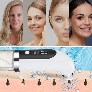 Electric Small Bubble Blackhead Remover USB Rechargeable Water Cycle Pore Acne Pimple Removal Vacuum Suction Facial Cleaner Tool