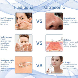 New Ultrasonic Ion Face Cleansing Skin Scrubber Peeling Shovel EMS Facial Pore Cleaner Nu Face Skin Lift Machine Galvanic Spa