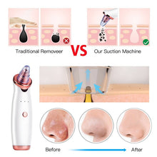 Load image into Gallery viewer, Vacuum Blackhead Remover Pimple Acne Removal Tool Skin Care Pore Cleaner Facial Diamond Dermabrasion Machine
