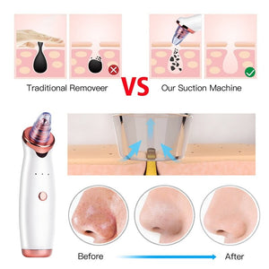 Vacuum Blackhead Remover Pimple Acne Removal Tool Skin Care Pore Cleaner Facial Diamond Dermabrasion Machine