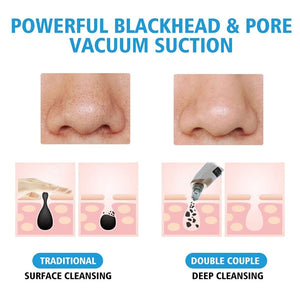 Electric Facial Blackhead Remover Vacuum Acne Spots Pore Black Dot Cleaner Pimple Remover Face Deep Cleaning Machine Beauty Tool
