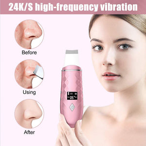 EMS Skin Scrubber Ultrasonic Facial Skin Spatula 36-42°C Heating Facial Cleansing Blackhead Remover Extractor Face Cleaning Tool