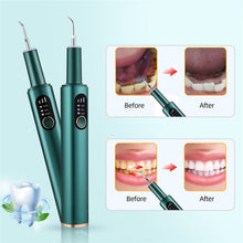 Load image into Gallery viewer, Ultrasonic Dental irrigator Smoke Stain Dental Plaque Cleaner 3 Modes Tooth Irrigator Oral Care Electric Dental Water Jet