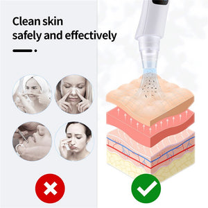 Blackhead Remover Face Nose Deep Cleaner Pore Acne Pimple Removal Vacuum Suction Facial Diamond Beauty Clean Skin Tool