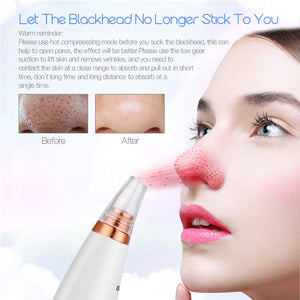 6 In 1 Electric Facial Blackhead Remover Vacuum Suction Pore Removal Deep Cleaning Face Cleanser +Nano Facial Steamer Sprayer