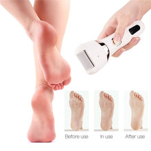 Load image into Gallery viewer, Electric Pedicure Foot Care Tool Files Pedicure Callus Remover Rechargeable Sawing File For Feet Dead Skin Callus Peel Remover