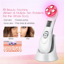 Load image into Gallery viewer, Facial Mesotherapy Electroporation RF Radio Frequency LED Photon Face Lifting Tighten Wrinkle Removal Skin Care Face Massager