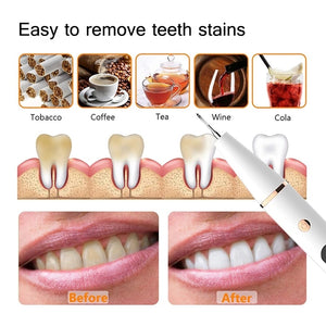 Electric Sonic Dental Calculus Scaler Oral Teeth Irrigator Calculus Remover Plaque Stains Cleaner Teeth Whitening LED Display