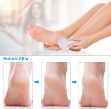 Load image into Gallery viewer, Portable Electric Grinder Pedicure Tools Foot Heel Care Tool Pedicura Velvet Smooth Machine Callus Remover for Foot Heel Skin