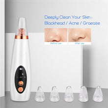 Load image into Gallery viewer, 6 In 1 Electric Facial Blackhead Remover Vacuum Suction Pore Removal Deep Cleaning Face Cleanser +Nano Facial Steamer Sprayer