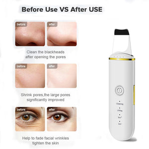 Ultrasonic Cleaner Skin Scrubber Face Cleansing Machine Facial Acne Blackhead Remover USB Charge Skin Care Beauty Device