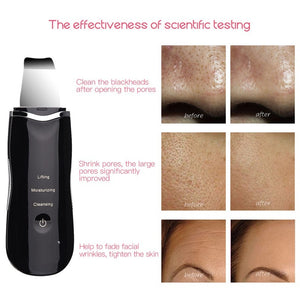 Ultrasonic Skin Scrubber Skin Peeling Extractor Facial Deep Cleaning Beauty Device + Skin Rejuvenation Nano Face Mist Steamer