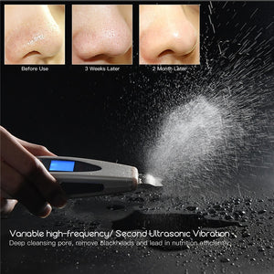Ultrasonic Skin Scrubber Deep Face Cleaning Machine Remove Dirt Blackhead Peeling Lifting Massager + Nano Facial Steamer Sprayer