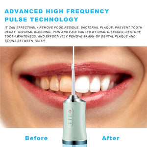 Profession Dental Water Flosser Teeth whitening Electric Irrigator Dental Irrigator Teeth Cleaning Machine Oral Care Tool