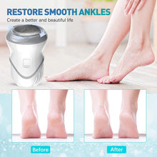 Load image into Gallery viewer, Portable Electric Vacuum Adsorption Foot Grinder Electronic Foot File Pedicure Tools Callus Remover Feet Care Sander