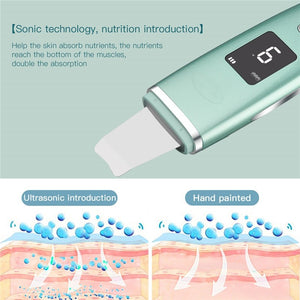 Ultrasonic Skin Scrubber Vibration EMS Ion Face Cleanser Blackhead Remover Peeling Pore Cleaner Facial Lifting Shovel Machine