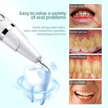 Load image into Gallery viewer, Electric Sonic Dental whitener Scaler Teeth Calculus Tartar Remover Cleaner Tooth Stain Oral Care Teeth Whitening Suits