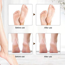 Load image into Gallery viewer, Rechargeable Foot Grinder USB Rechargeable Feet Callus Remover Foot Care Callus Remover With LED Indicator Light For Women Men