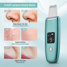 Load image into Gallery viewer, Ultrasonic Skin Scrubber EMS Facial Pore Deep Cleansing Spatula Blackhead Dead Skin Remover Acne Extractor Face Lifting Massager