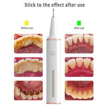 Load image into Gallery viewer, Electric Ultrasonic Dental Calculus Remover Visible Wifi Bluetooth Irrigator USB Rechargeable Teeth Whitening Scaler for Home