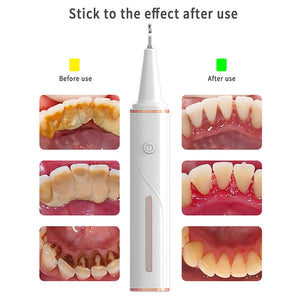 Electric Ultrasonic Dental Calculus Remover Visible Wifi Bluetooth Irrigator USB Rechargeable Teeth Whitening Scaler for Home
