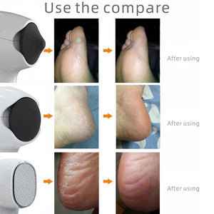Pedicure Tools Skin Care Electric Foot File Dead Skin Callus Remover USB Foot Grinder Machine Foot Care Tool