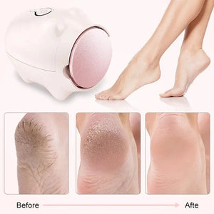 Lovely Pig Shaped Foot Files Foot Skin Care Electric Foot Callus Easy Disassembly Exfoliator Feet Callus Remover