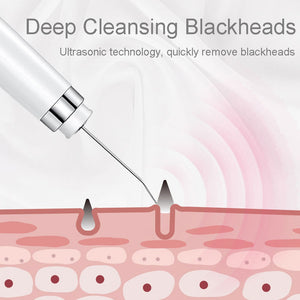 Ultrasonic Skin Scrubber Electric Facial Cleansing Pore Deep Clean Acne Blackhead Remover Peeling Shovel Beauty Machine
