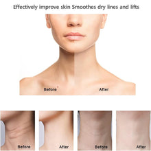 Load image into Gallery viewer, Neck Facial Lifting Device LED Photon EMS Neck Face Skin Tighten Reduce Double Chin Anti Wrinkle