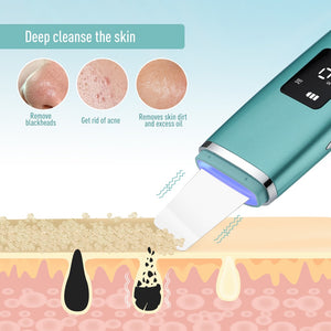 Ultrasonic Skin Scrubber EMS Facial Pore Deep Cleansing Spatula Blackhead Dead Skin Remover Acne Extractor Face Lifting Massager