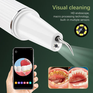 Visual Electric Dental Scaler Ultrasonic Teeth Whitening Tooth Cleaner Calculus Remover With Camera Irrigator Tartar Eliminator
