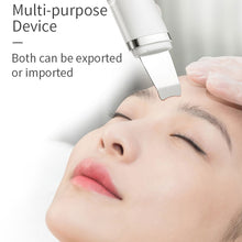 Load image into Gallery viewer, Ultrasonic Skin Scrubber Electric Facial Cleansing Pore Deep Clean Acne Blackhead Remover Peeling Shovel Beauty Machine