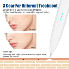 Load image into Gallery viewer, Plasma Pen Face Skin Tag Remover Wart Black Spots Freckle Papillomas Remover Electric Plasma Jet Pen Skin Care Beauty Devices