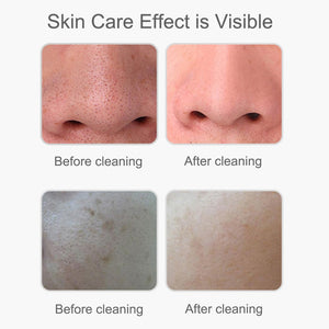 Ultrasonic Skin Scrubber Electric Facial Cleansing Pore Deep Clean Acne Blackhead Remover Peeling Shovel Beauty Machine