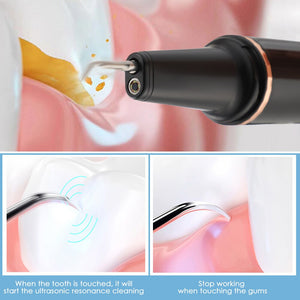 Visual Ultrasonic Teeth Cleaner Dental Scaler Electric Calculus Stain Remover Tartar Wifi LED Teeth Whitening Dental Oral Care